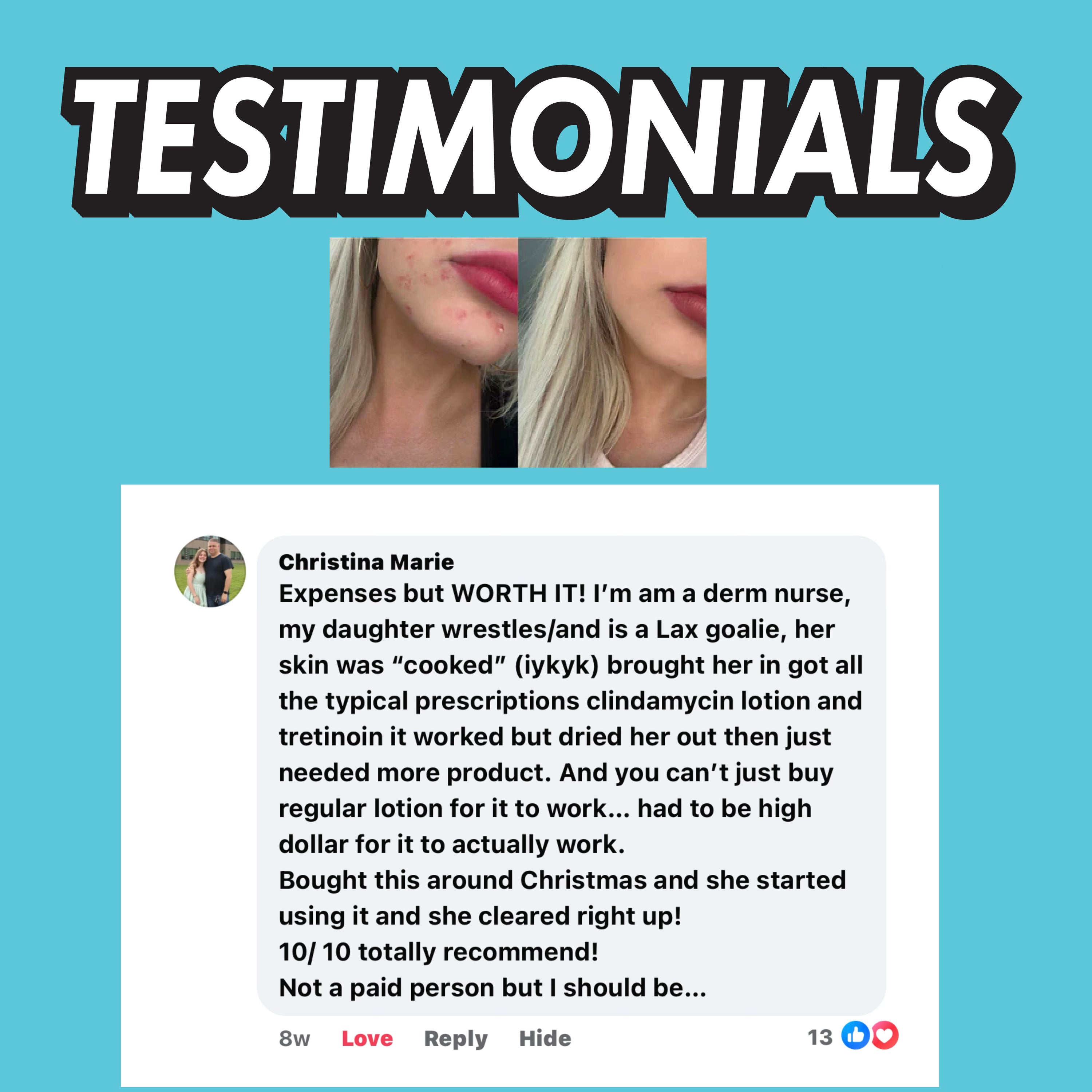 Beach Bliss Face Scrub (Medium Acne)