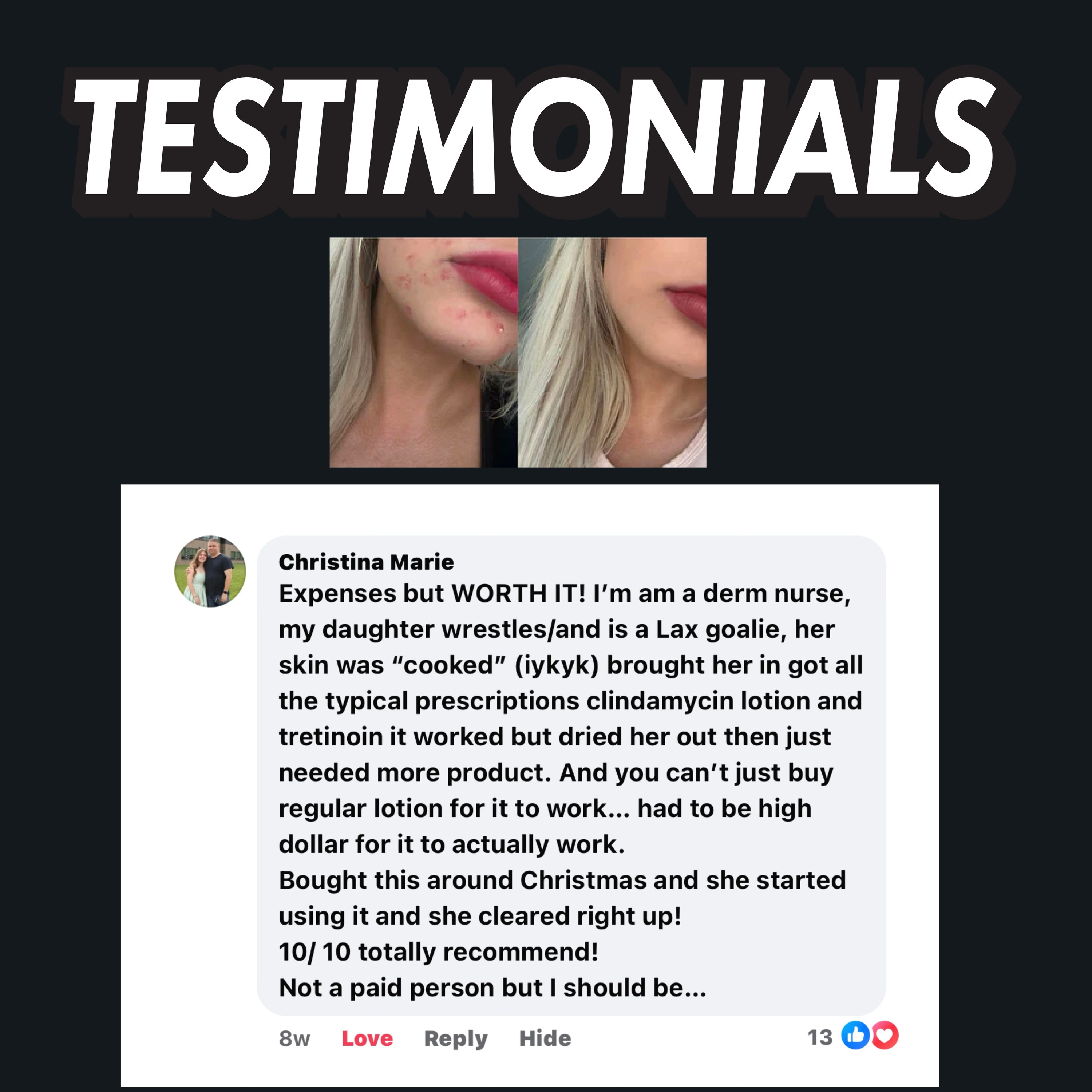 Black Diamond Face Scrub (Severe Acne)