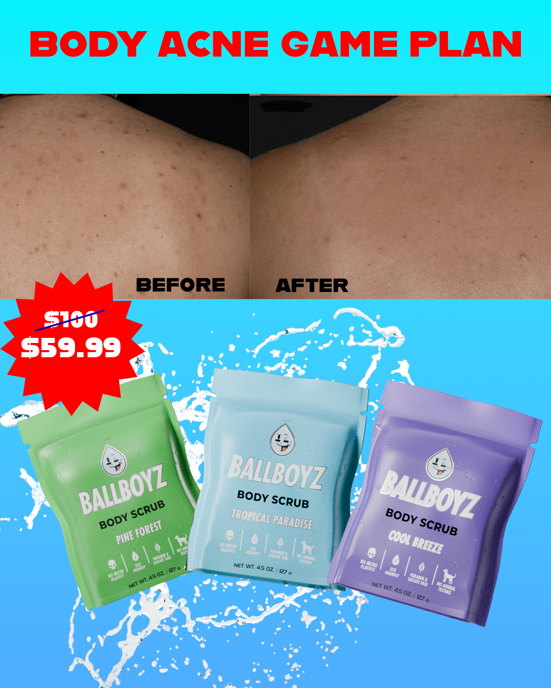 Boyz Body Acne Gameplan