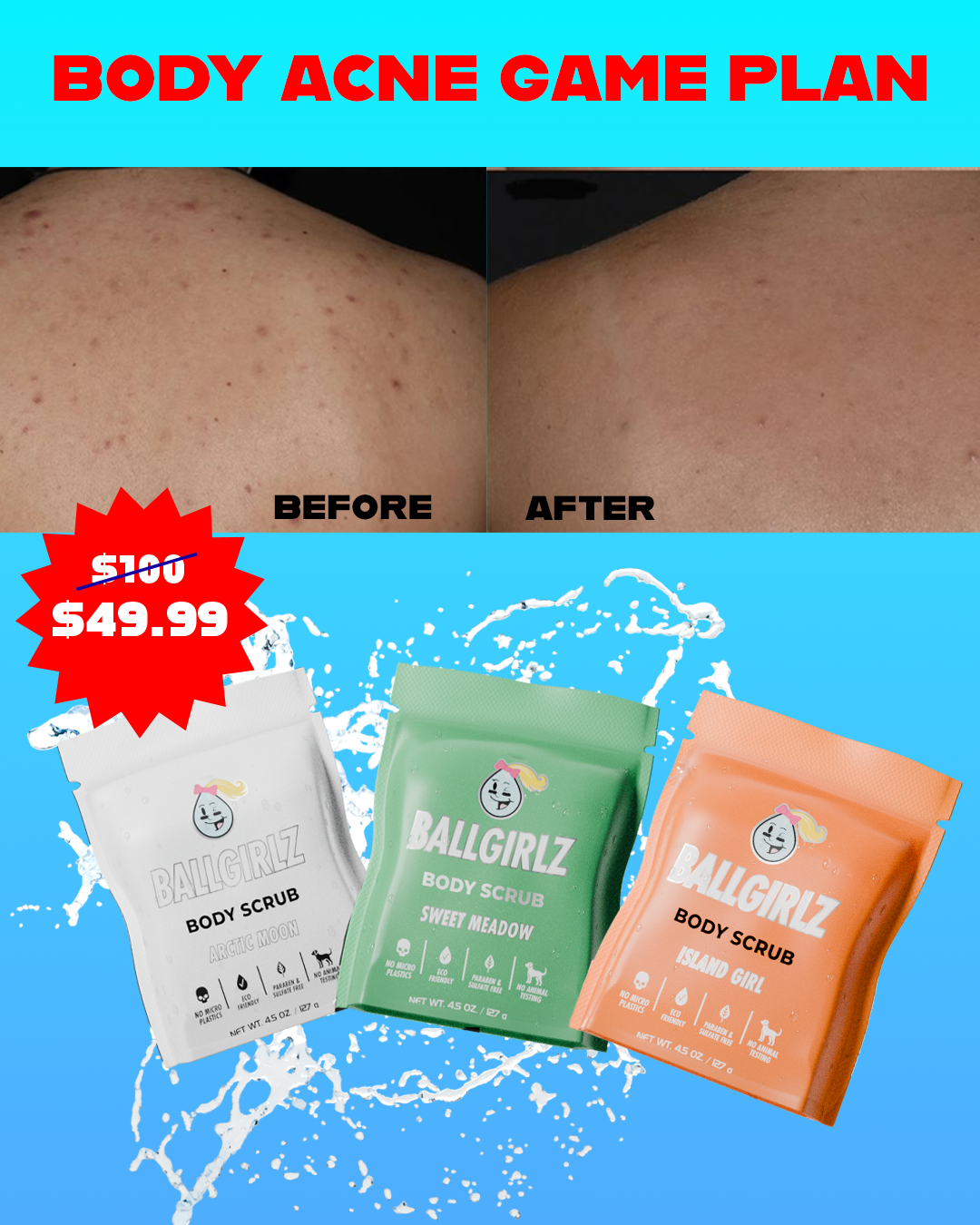 Girlz Body Acne Gameplan